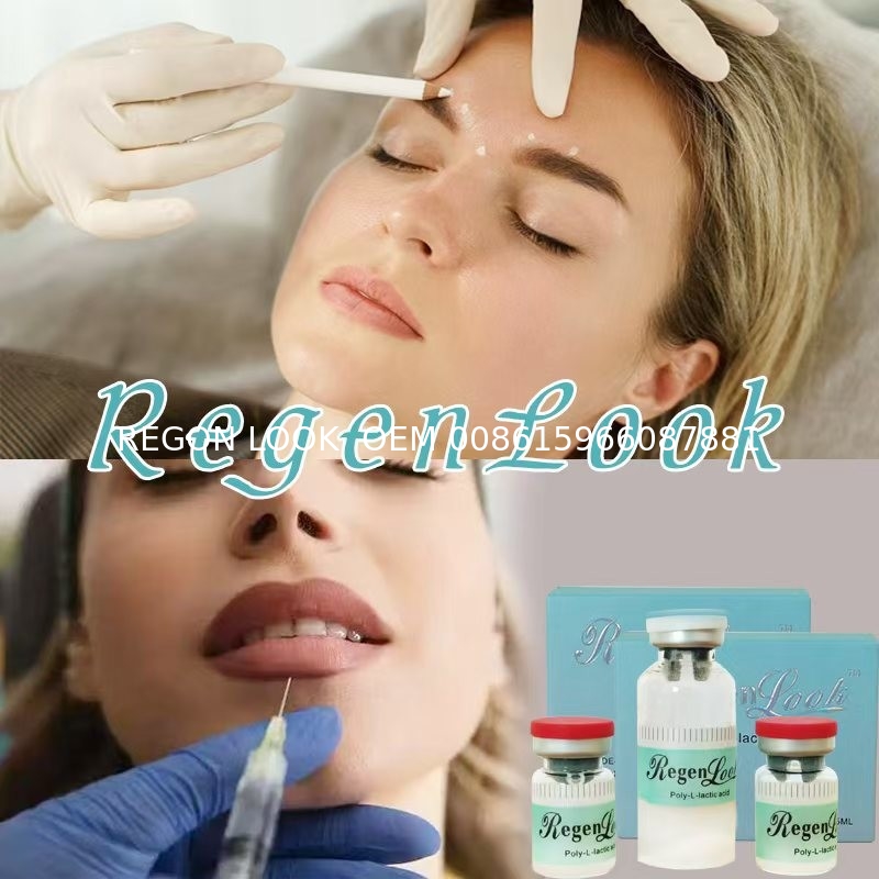 PLLA Poly-L-Lactic Acid Injection 365mg 5ml Lysozyme PLLA Injectable Skin Booster Dermal Filler for Sale