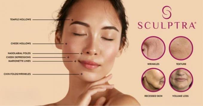 Wholesale REGEN LOOK Anti Aging Anti Wrinkle PLLA Poly-L-Lactic Acid 6